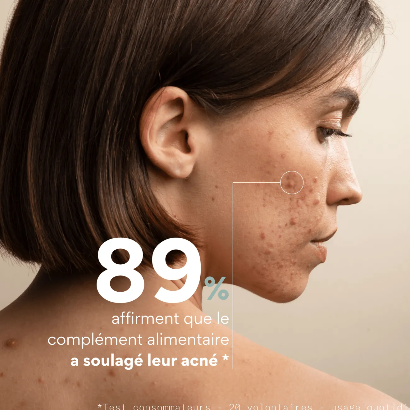 Complément Alimentaire Nettoyant Peau Acné Bio