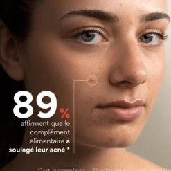 Complément Alimentaire Stop-Boutons Bio
