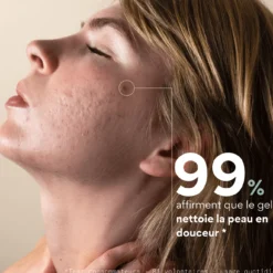 Gel Nettoyant Equilibrant Acné
