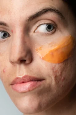 Masque Exfoliant Anti-Acné