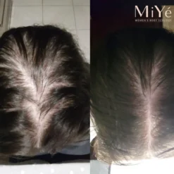 MY Sérum Cheveux Densifiant Anti-Chute